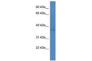 Western Blot showing Fank1 antibody used at a concentration of 1-2 ug/ml to detect its target protein. (FANK1 Antikörper  (Middle Region))