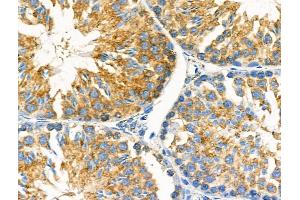 ABIN6259308 and ABIN6275426 at 1/100 staining Mouse testis tissue by IHC-P.