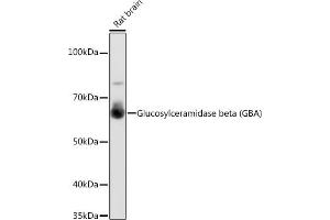 Western blot analysis of extracts of Rat brain, using Glucosylceramidase beta (Glucosylceramidase beta (GBA)) antibody (ABIN7267407) at 1:1000 dilution. (GBA Antikörper)