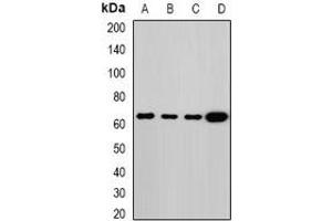Western blot analysis of Melanophilin expression in MCF7 (A), HT29 (B), mouse lung (C), rat lung (D) whole cell lysates. (Melanophilin Antikörper)