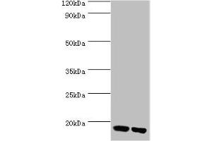Western blot All lanes: Peptidyl-prolyl cis-trans isomerase FKBP2 antibody at 10 μg/mL Lane 1: Mouse thymus tissue Lane 2: Rat brain tissue Secondary Goat polyclonal to rabbit IgG at 1/10000 dilution Predicted band size: 16 kDa Observed band size: 16 kDa (FKBP2 Antikörper  (AA 22-142))