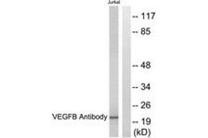 Western blot analysis of extracts from Jurkat cells, using VEGFB Antibody. (VEGFB Antikörper  (AA 91-140))