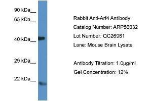 Western Blotting (WB) image for anti-ADP-Ribosylation Factor 4 (ARF4) (N-Term) antibody (ABIN785783) (ARF4 Antikörper  (N-Term))