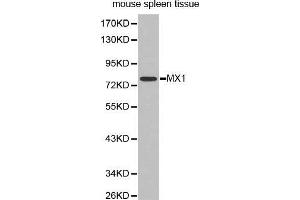 Western Blotting (WB) image for anti-Myxovirus Resistance Protein 1 (MX1) (AA 368-662) antibody (ABIN3022533) (MX1 Antikörper  (AA 368-662))