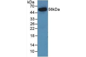 Detection of Recombinant AGT, Rat using Monoclonal Antibody to Angiotensinogen (AGT) (AGT Antikörper  (AA 25-477))