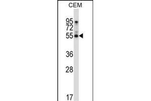 LMD Antibody (N-term) (ABIN657125 and ABIN2846269) western blot analysis in CEM cell line lysates (35 μg/lane). (PALMD Antikörper  (N-Term))