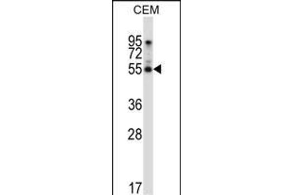 PALMD Antikörper  (N-Term)