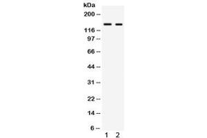 Western blot testing of 1) rat liver and 2) mouse liver lysate with RIP140 antibody. (NRIP1 Antikörper)
