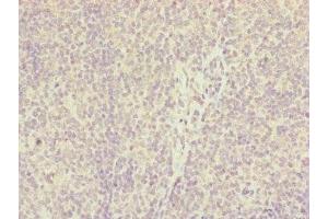 Immunohistochemistry of paraffin-embedded human tonsil tissue using ABIN7156903 at dilution of 1:100 (IL36A/IL1F6 Antikörper  (AA 1-158))