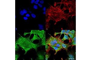 Immunocytochemistry/Immunofluorescence analysis using Mouse Anti-Notch1 Monoclonal Antibody, Clone S253-32 .