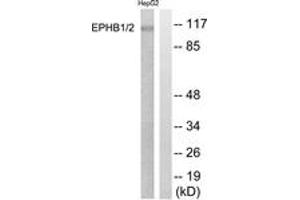 Western blot analysis of extracts from HepG2 cells, using EPHB1/2 (Ab-594/604) Antibody. (EPHB1/2 Antikörper  (AA 561-610))