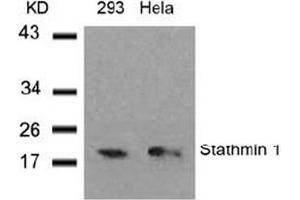 Image no. 3 for anti-Stathmin 1 (STMN1) (Ser37) antibody (ABIN197456) (Stathmin 1 Antikörper  (Ser37))