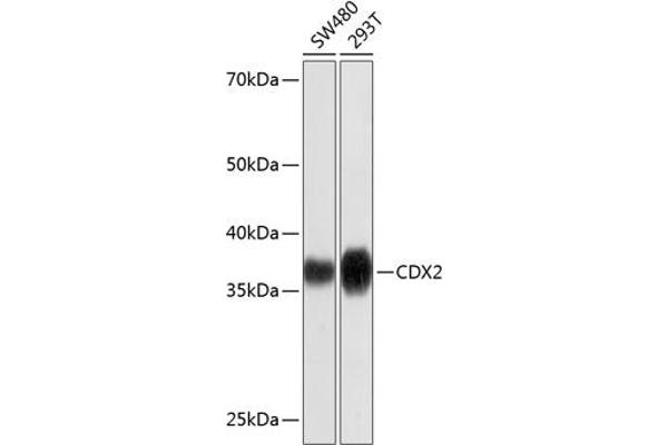 CDX2 Antikörper
