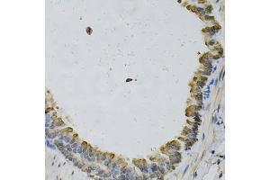 Immunohistochemistry of paraffin-embedded mouse lung using EFNA1 Antibody (ABIN5973078) at dilution of 1/100 (40x lens). (Ephrin A1 Antikörper)