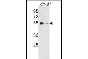 Western blot analysis of EEF1A1/ EEF1A2 Antibody (N-term) (ABIN390520 and ABIN2840872) in Y79, T47D cell line lysates (35 μg/lane). (EEF1A2 Antikörper  (AA 46-72))