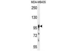 AXIN1 Antibody (C-term) western blot analysis in MDA-MB435 cell line lysates (35µg/lane). (Axin Antikörper  (C-Term))