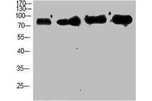 Western Blot analysis of customer's using p63 Polyclonal Antibody. (p63 Antikörper  (N-Term))