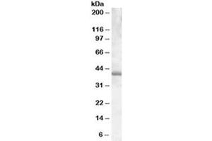 Western blot testing of Daudi lysate with PU. (SPI1 Antikörper)