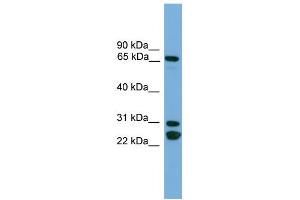 WB Suggested Anti-DNAI2  Antibody Titration: 0. (DNAI2 Antikörper  (N-Term))