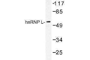 Image no. 1 for anti-Heterogeneous Nuclear Ribonucleoprotein L (HNRNPL) antibody (ABIN272168) (HNRNPL Antikörper)