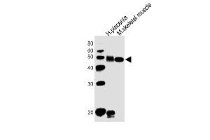 All lanes : Anti-DLK1 Antibody (C-term) at 1:1000 dilution Lane 1: human placenta lysates Lane 2: mouse skeletal muscle lysates Lysates/proteins at 20 μg per lane. (DLK1 Antikörper  (C-Term))