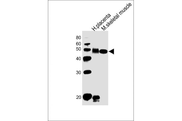 DLK1 Antikörper  (C-Term)