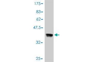 Western Blot detection against Immunogen (37. (ErbB2/Her2 Antikörper  (AA 22-121))