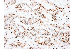 Immunohistochemistry (IHC) image for anti-Sjogren Syndrome Antigen B (SSB) (AA 358-408) antibody (ABIN7453946)