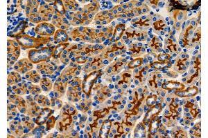 ABIN6260462 and ABIN6278357 at 1/100 staining Mouse kidney tissue by IHC-P. (CARD9 Antikörper  (C-Term))
