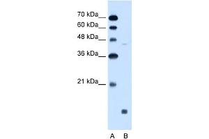 WB Suggested Anti-EDG8 Antibody Titration:  0.