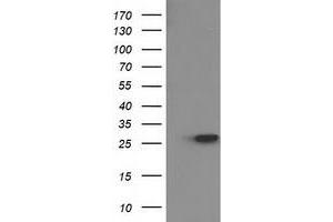 Western Blotting (WB) image for anti-Hydroxyprostaglandin Dehydrogenase 15-(NAD) (HPGD) antibody (ABIN1496362) (HPGD Antikörper)