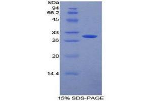 SDS-PAGE (SDS) image for Fc gamma RII (CD32) (AA 69-309) protein (His tag,T7 tag) (ABIN2126628) (Fc gamma RII (CD32) (AA 69-309) protein (His tag,T7 tag))