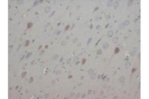 Immunohistochemical analysis of paraffin embedded rat tissue sections (brain) using NT3 antibody (Neurotrophin 3 Antikörper  (Middle Region))