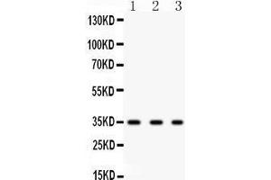 Western Blotting (WB) image for anti-Secreted Protein, Acidic, Cysteine-Rich (Osteonectin) (SPARC) (AA 268-303), (C-Term) antibody (ABIN3043352) (SPARC Antikörper  (C-Term))