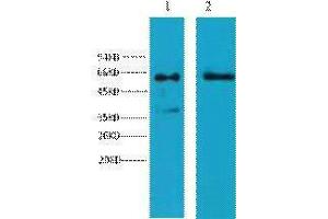 Western Blotting (WB) image for anti-Keratin 6 (KRT6) antibody (ABIN3178633) (Keratin 6 Antikörper)