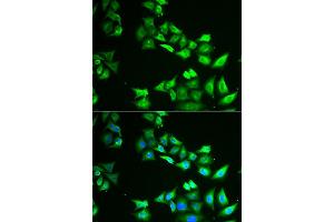 Immunofluorescence analysis of HeLa cell using CCBL1 antibody. (CCBL1 Antikörper)