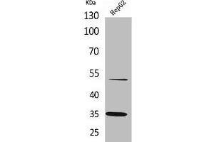Western Blot analysis of HepG2 cells using TFPI Polyclonal Antibody (TFPI Antikörper  (C-Term))