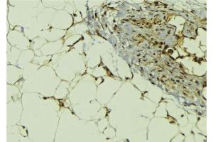 ABIN6278791 at 1/100 staining Human lung tissue by IHC-P. (MBIP Antikörper  (Internal Region))