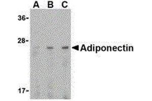 Western Blotting (WB) image for anti-Adiponectin (ADIPOQ) (C-Term) antibody (ABIN2477286) (ADIPOQ Antikörper  (C-Term))