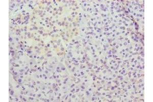 Immunohistochemistry of paraffin-embedded human pancreatic tissue using ABIN7159667 at dilution of 1:100 (METTL25 Antikörper  (AA 206-455))