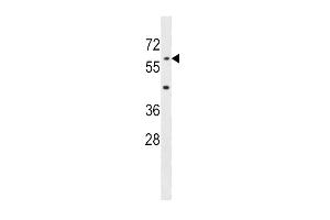 AOAH Antibody (Center) (ABIN1537935 and ABIN2848953) western blot analysis in mouse liver tissue lysates (35 μg/lane). (AOAH Antikörper  (AA 168-197))