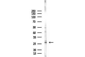 anti-DNA-Damage-Inducible Transcript 3 (DDIT3) (N-Term) antibody