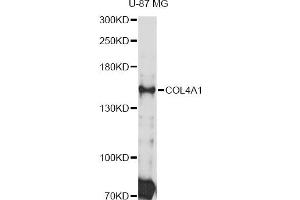 Western blot analysis of extracts of U-87 MG cells, using COL4A1 Antibody (ABIN4903336) at 1:3000 dilution. (COL4A1 Antikörper)