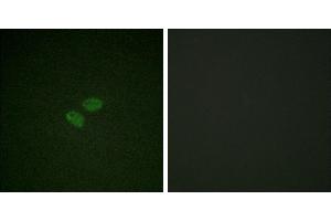 Peptide - +Immunofluorescence analysis of HeLa cells, using CDC16/APC6 (Ab-560) antibody. (CDC16 Antikörper  (Ser560))