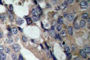 Image no. 1 for anti-Heat Shock 27kDa Protein 1 (HSPB1) antibody (ABIN265470) (HSP27 Antikörper)