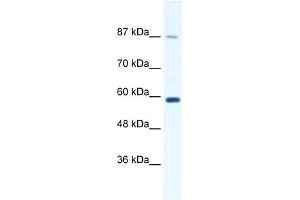 KIF23 antibody used at 1. (KIF23 Antikörper  (N-Term))