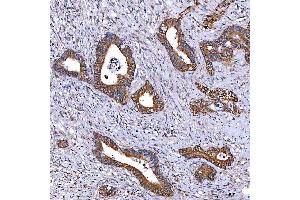 IHC analysis of TOMM34 using anti-TOMM34 antibody (ABIN7599253). (TOMM34 Antikörper  (AA 1-309))