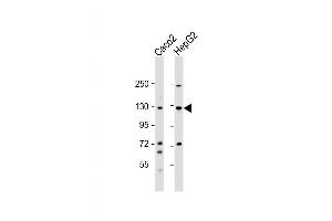 Western Blot at 1:1000 dilution Lane 1: Caco2 whole cell lysate Lane 2: HepG2 whole cell lysate Lysates/proteins at 20 ug per lane.