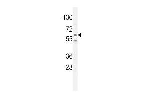 PRK (Thr172) Antibody (ABIN654800 and ABIN2844475) western blot analysis in K562 cell line lysates (35 μg/lane). (PRKAA2 Antikörper  (Thr172))