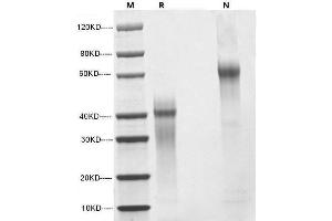 SDS-PAGE (SDS) image for Interleukin 12 (IL12) (AA 23-219), (AA 23-328) (Active) protein (ABIN2018013)